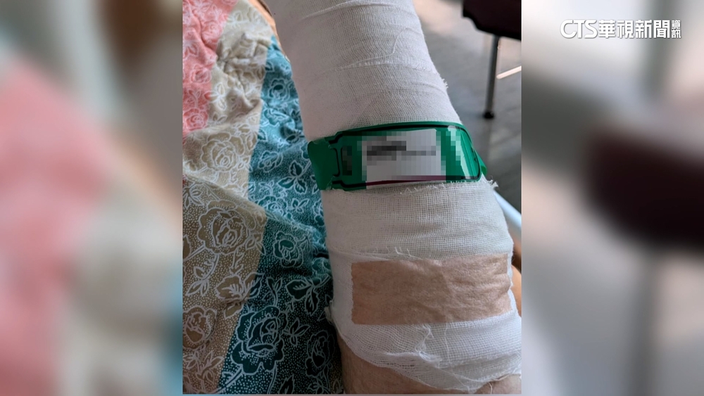 買早餐莫名被打斷手！鄰控動粗男常罵人　居民恐慌