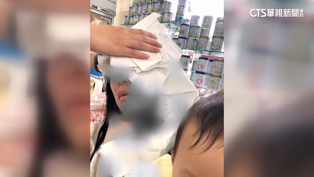 女遭停車場柵欄砸頭控冷處理喊告　業者：保險處理中