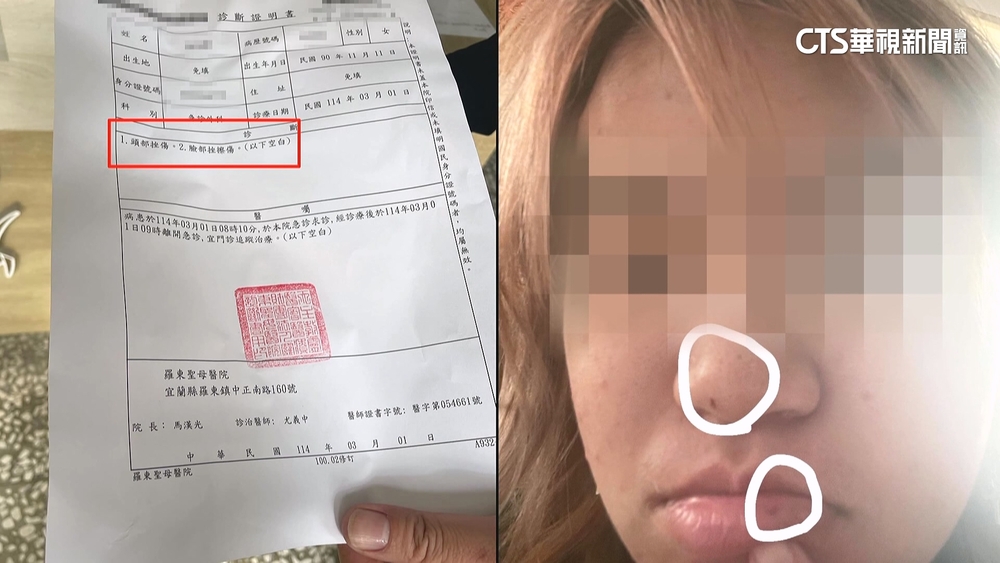 火爆！　宜蘭女買早餐遭隨機毆打　店員嚇：攔都攔不住