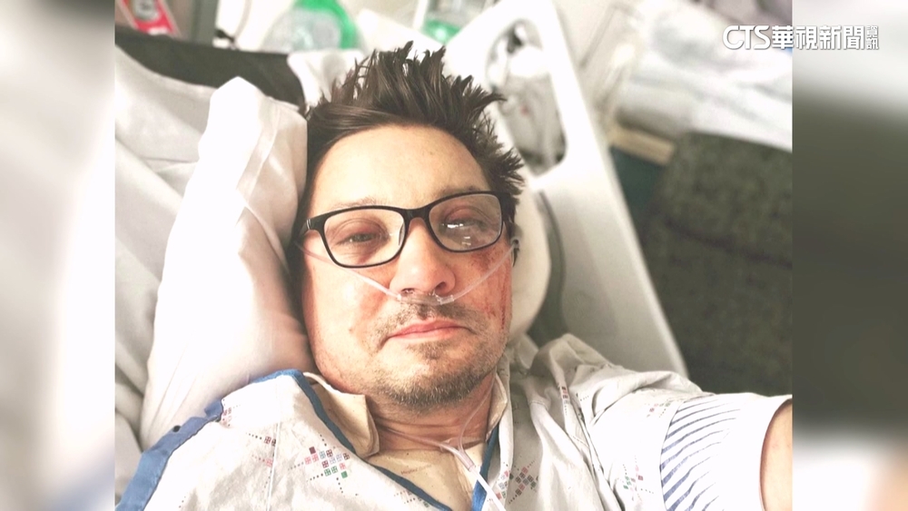 「鷹眼」憶遭剷雪車輾過　右眼目睹左眼爆出