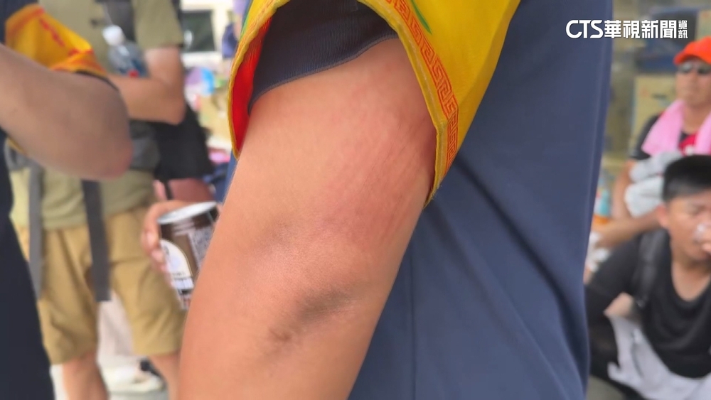 為避國道急行通過　白沙屯媽祖「直播君」絆倒慘摔