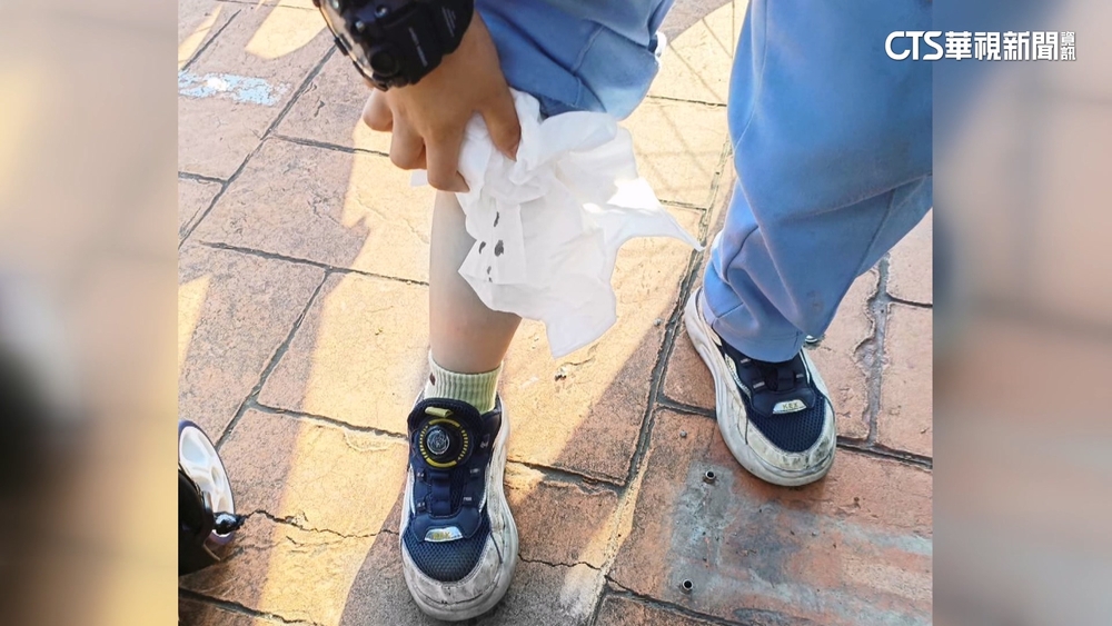 單車租借站撤點未移除「地虎」　男童絆倒縫4針