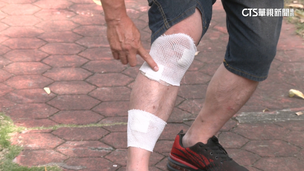 遛狗遭大型犬攻擊！人犬雙掛彩　對方飼主疑落跑