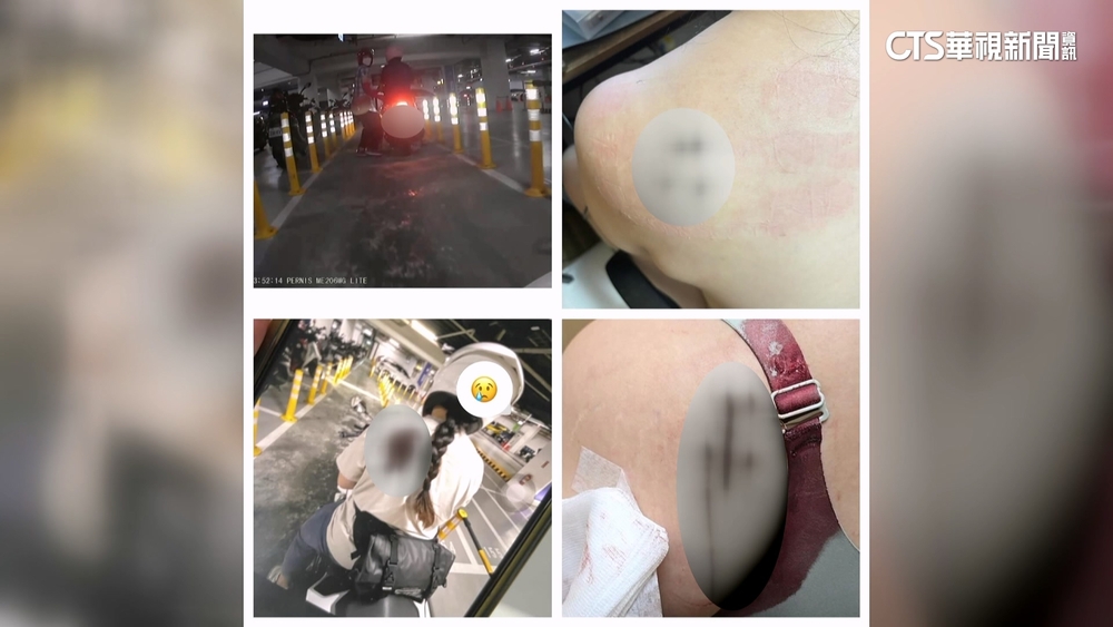 「催油門」惹殺身之禍？　女騎士突遭陌生男攻擊中4刀