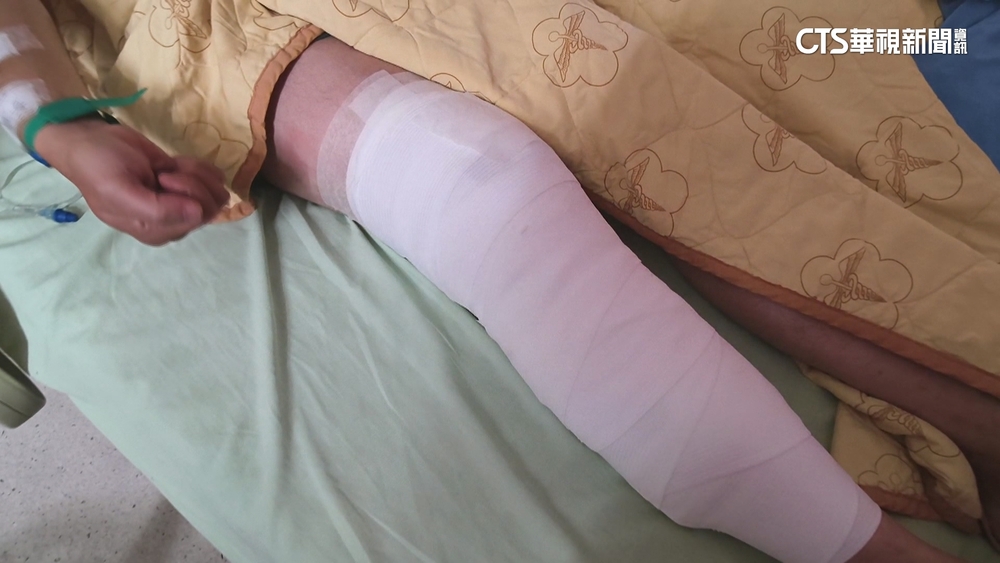 獒犬半月咬傷2人「開門就咬」　動保處稽查開罰