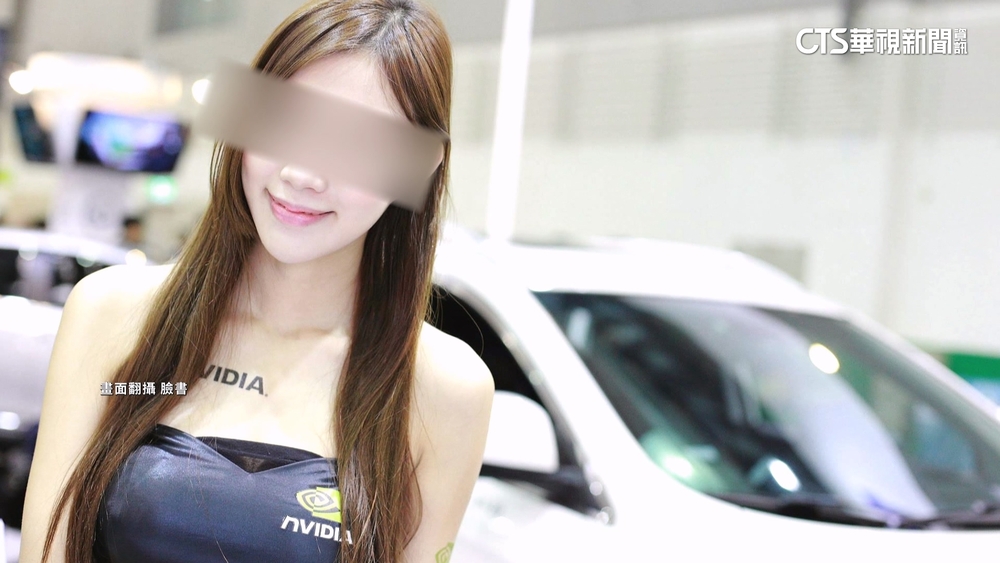 醫美診所打牛奶針出事！　昏迷病患是「車模界林志玲」