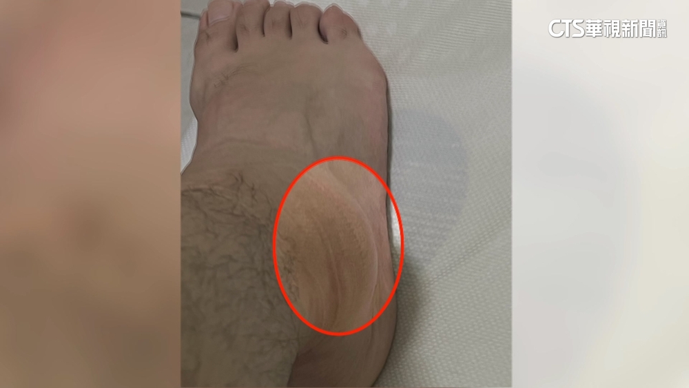 荷蘭學生來台交流　控台大校園內遭陌生男攻擊