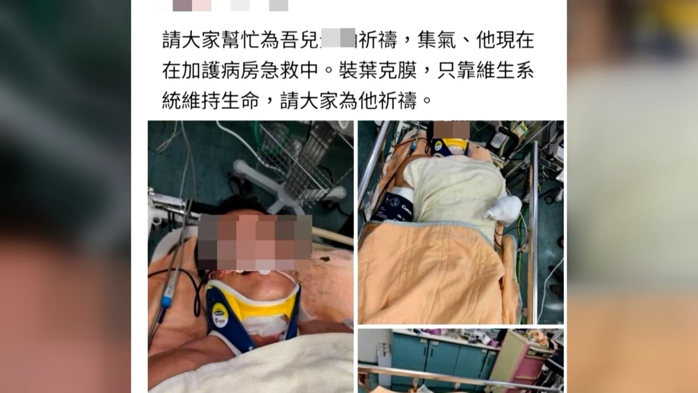 台電人員搶修遭電擊命危　父發文集氣：請為他祈禱