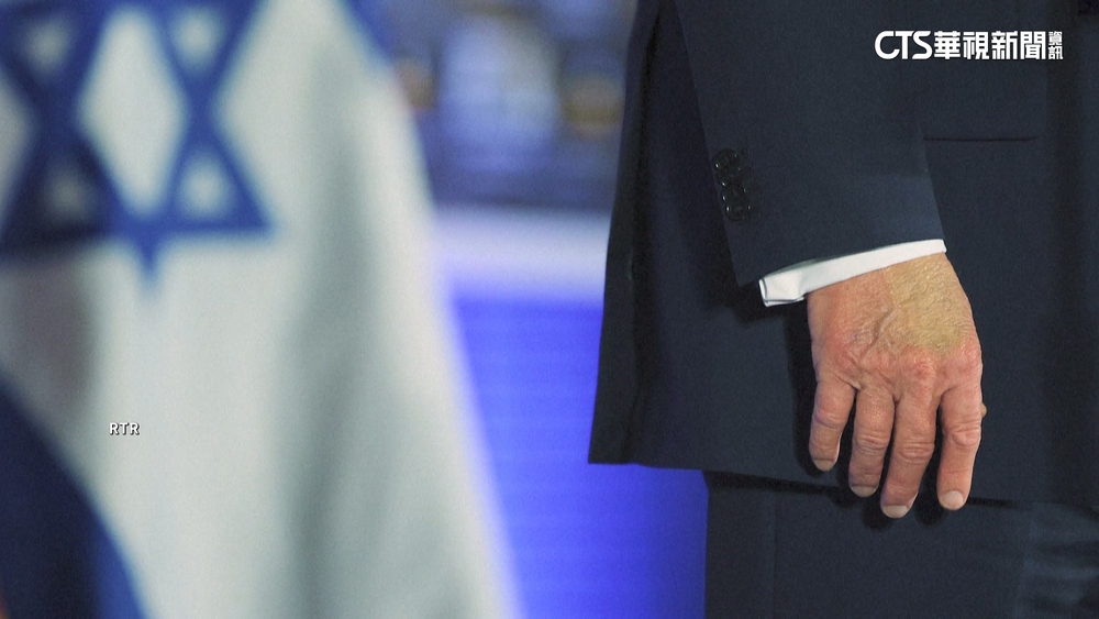 手背瘀青.小腿腫脹　白宮：川普罹「慢性靜脈功能不全」