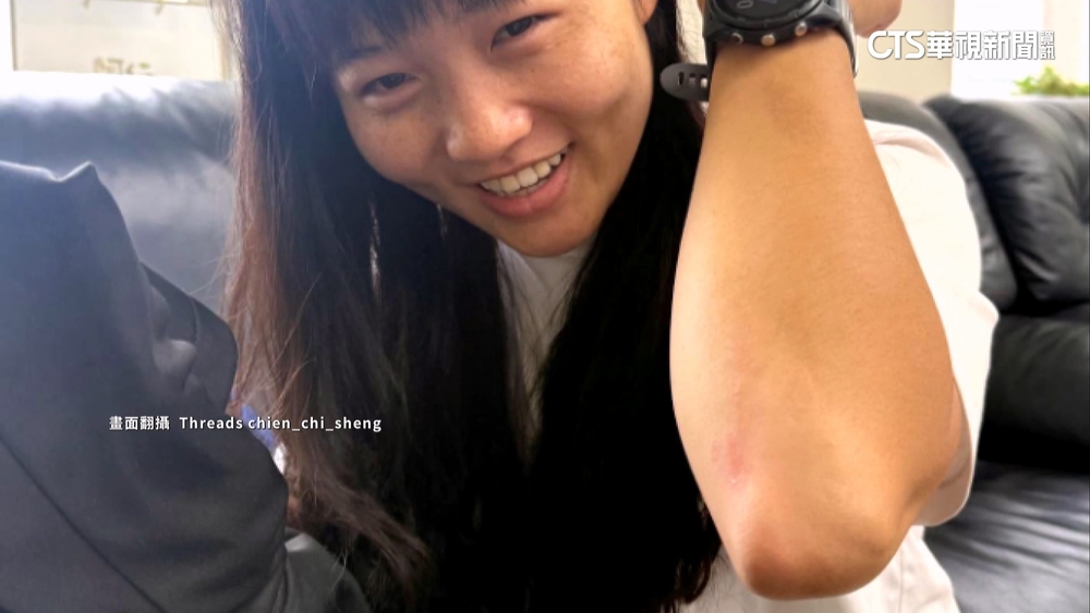 師大開記者會前小插曲　簡同學騎車打滑沒大礙