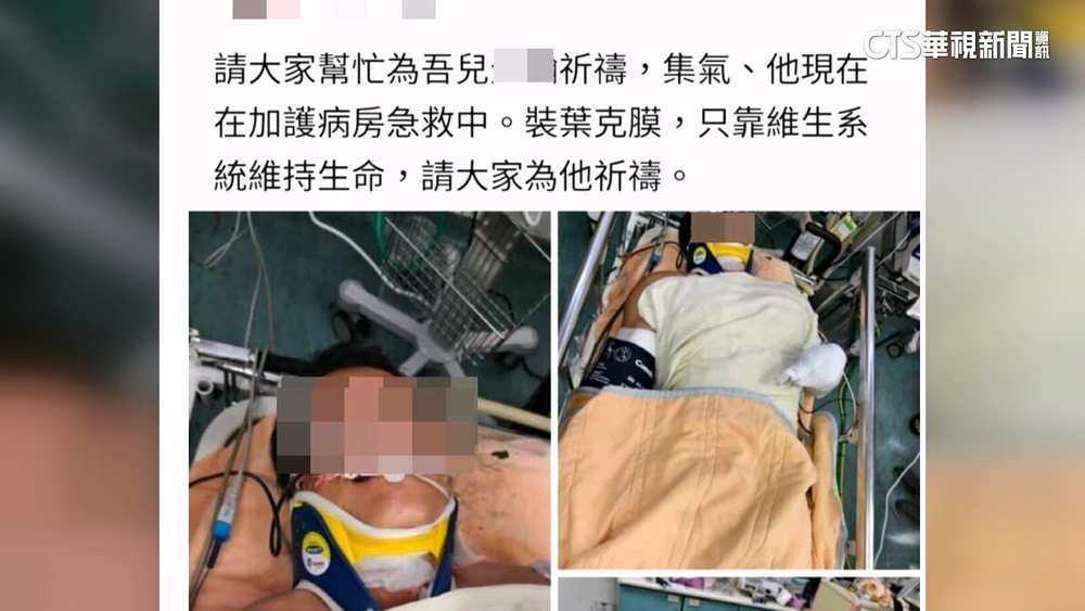 台電員工遭電擊　搶救6天家屬放棄急救簽器捐