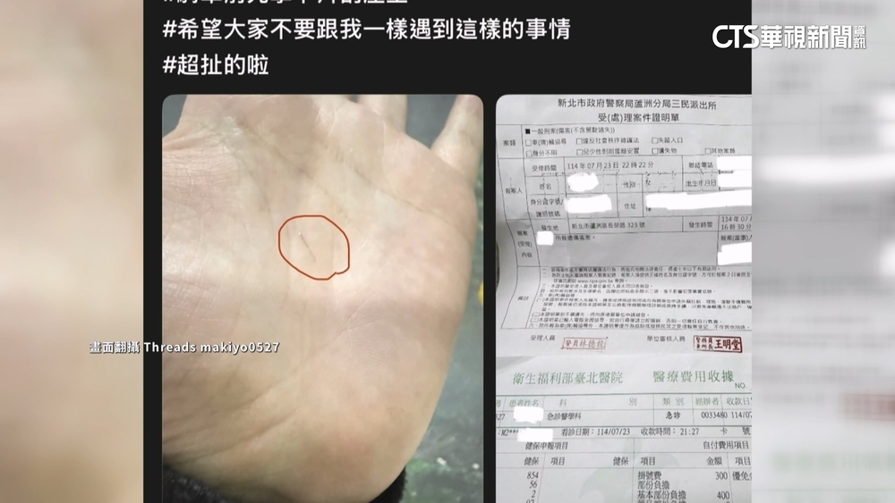 痛痛的？　機車坐墊莫名出現針頭！　騎士憂感染急驗傷