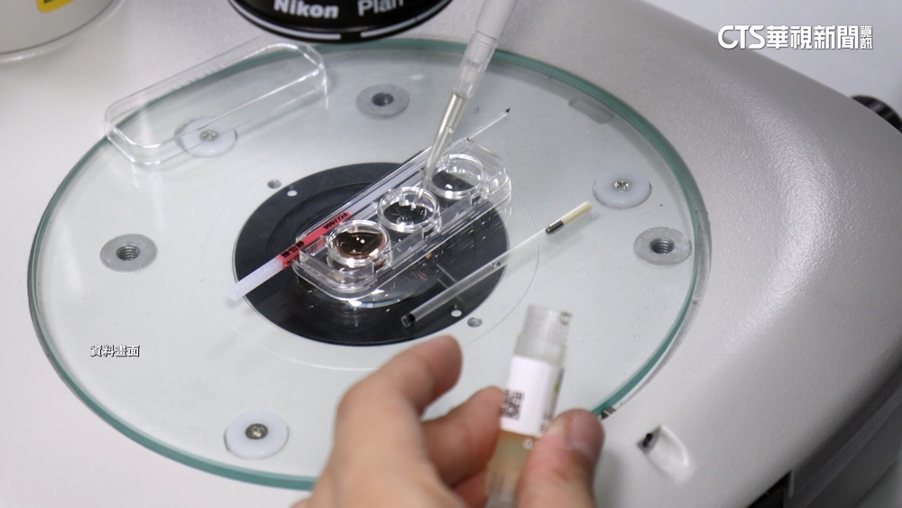 18-40歲乳癌.血癌患者　9月起凍精卵可獲補助