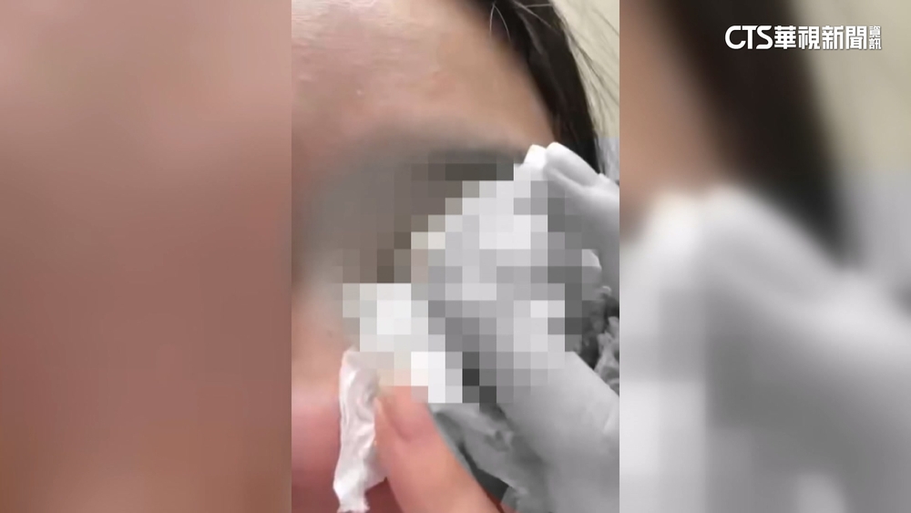 恐怖情人求復合狂騷擾　男暴打前女友害左眼失明