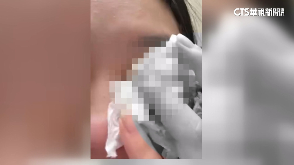 又見恐怖情人！　男求復合不成狠毆前女友致左眼失明