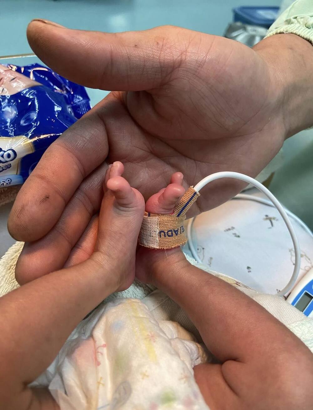 平安抵達！早產兒「小平安」順利轉院　紅斑馬全程護送