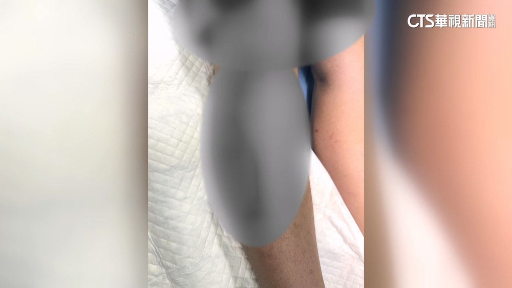 校園驚傳美工刀傷人　搶奪課本引爆衝突　校方：會懲處.輔導