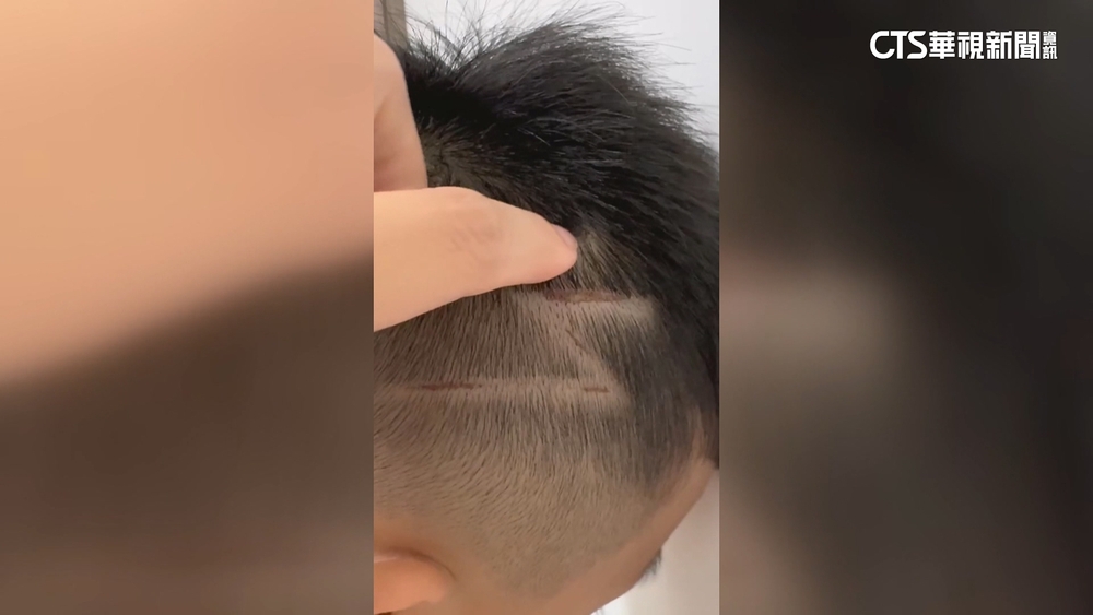 剪髮剃出閃電刀痕！　5歲童喊痛　業者3度鞠躬道歉