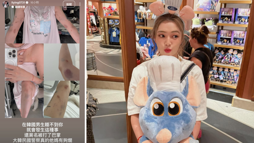 台YTR 在韓國「拒絕陪睡」遭暴打　瘀青照嚇壞網：歐巴的巴 是打巴掌的巴