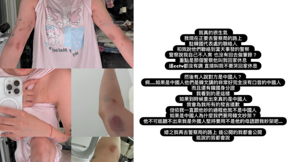 劉力穎在韓國遭毆打　男子身分曝光為「中國籍」　本人氣炸：在去警局的路上
