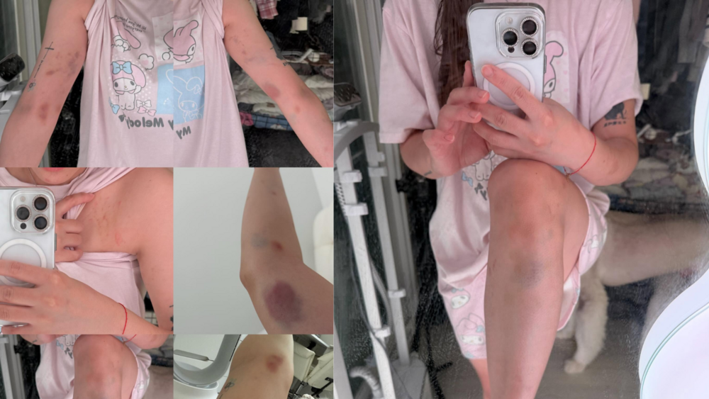 劉力穎在韓被毆打案反轉！　韓警「搞錯案」：施暴者不是中國籍 是韓國男子