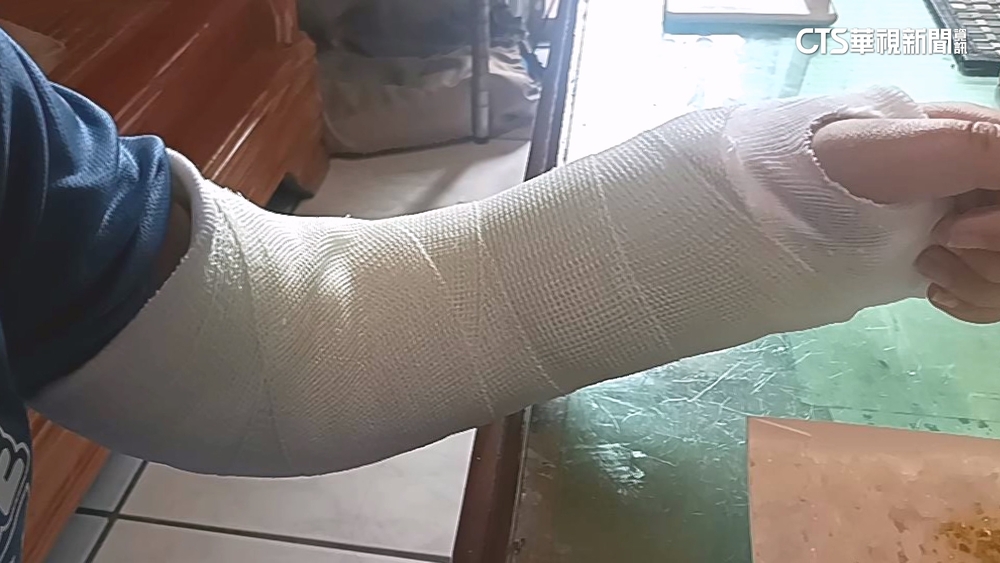 家長親眼目睹兒遭拋飛趴地　8歲童左手腕橈骨骨折