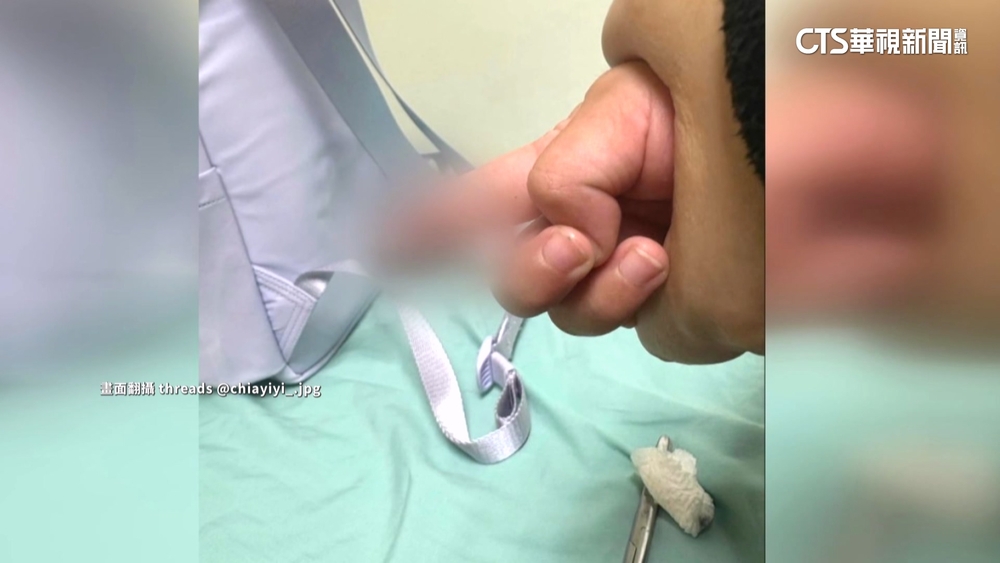 空泳池上直排輪課！女童手指縫4針　家長追受傷原因