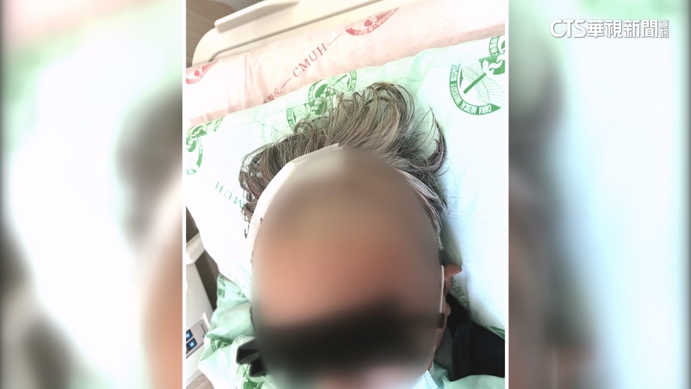 暈眩自撞！復康巴士駕駛確認罹腦瘤　丟工作還須賠40萬