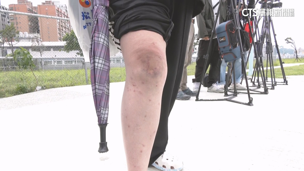 搭手扶梯「鞋帶捲入」跌傷　民眾控百貨未賠.業者：設備正常