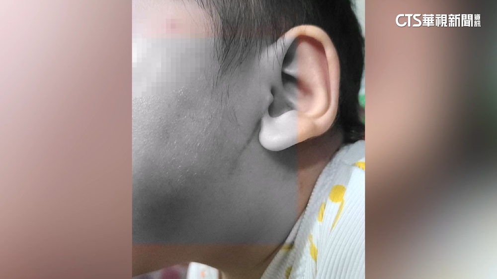 心碎！1個月凌虐逾20次害嬰腦出血　台南2保母遭羈押